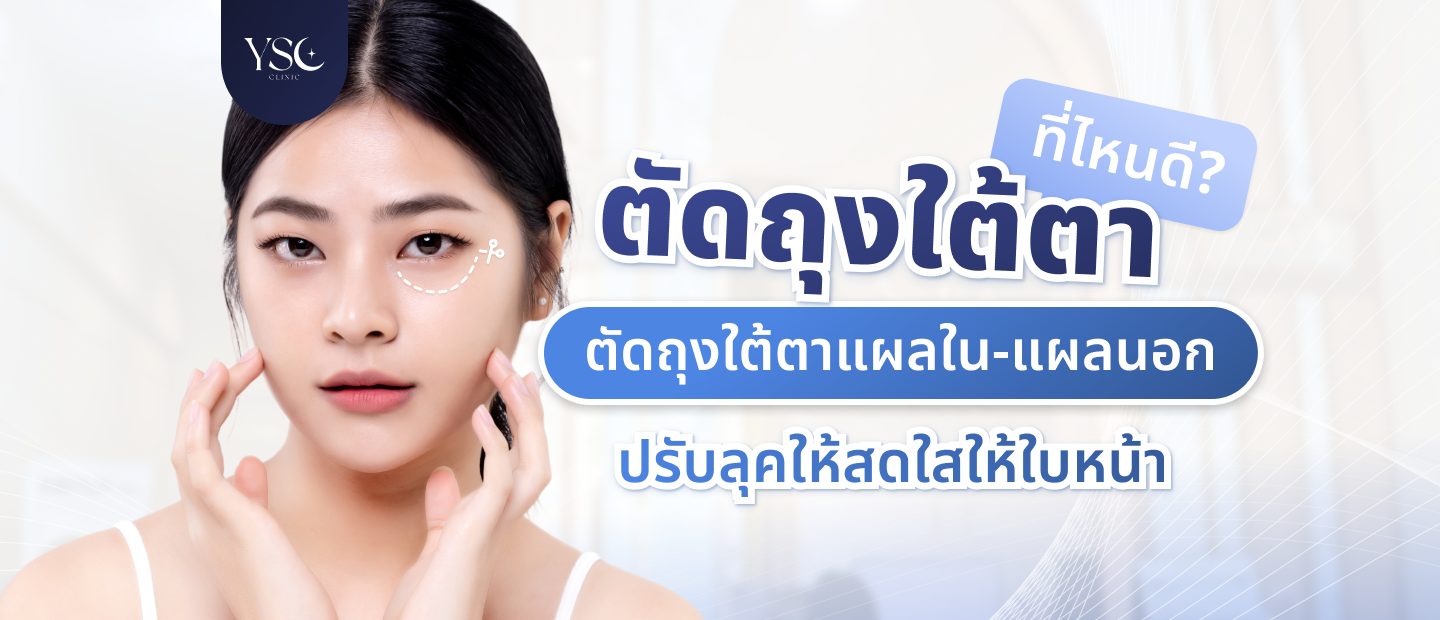 ตัดถุงใต้ตา